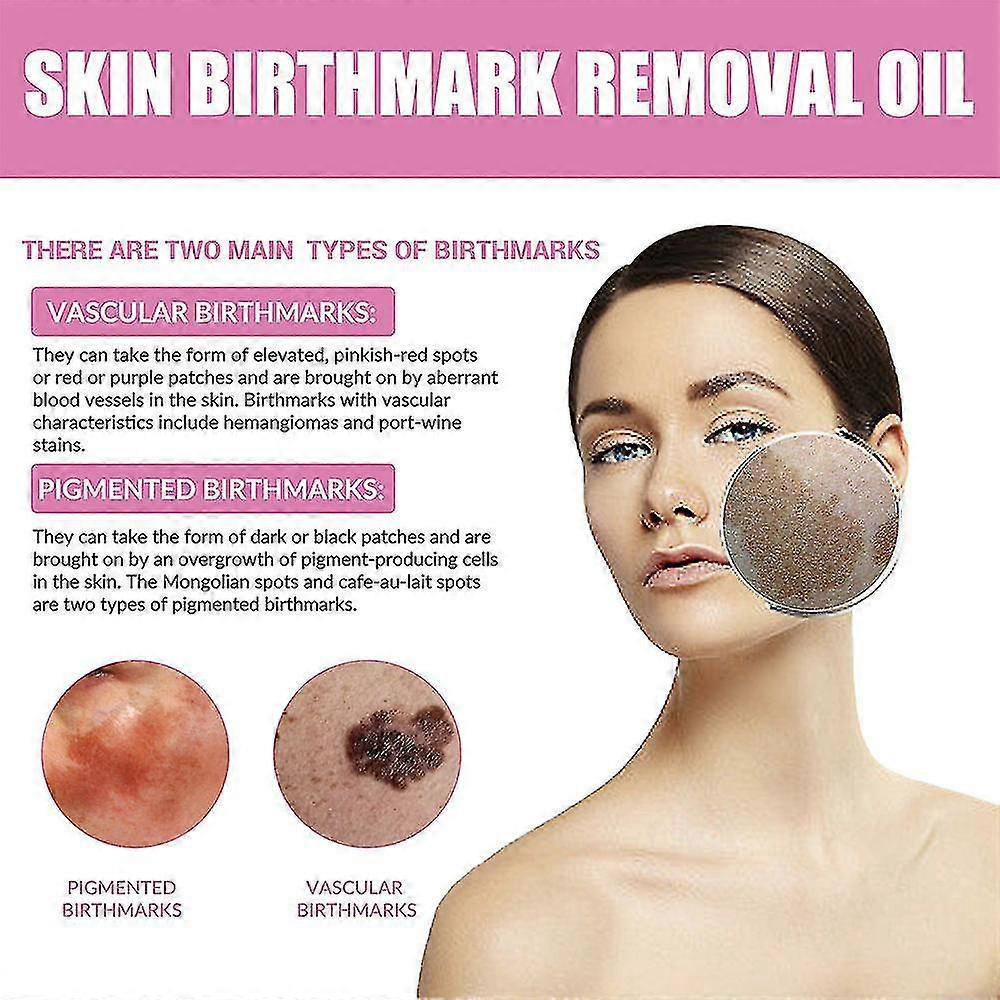 Birthmark Removal Oil 10ML (Pack of 2)